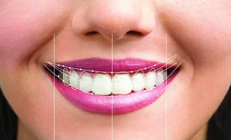 Revolutionize Your Smile with Digital Smile Design