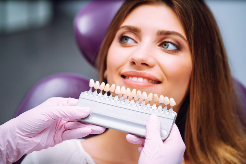 NACCID Smile Makeover Trends beautiful woman preparing for teeth whitening