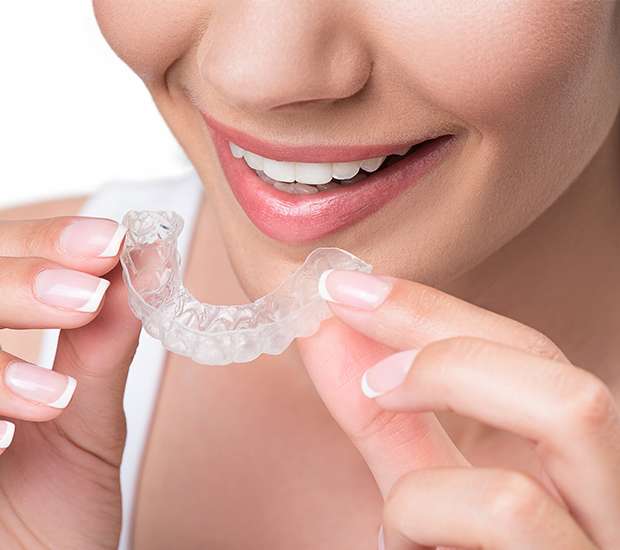 clear-aligners