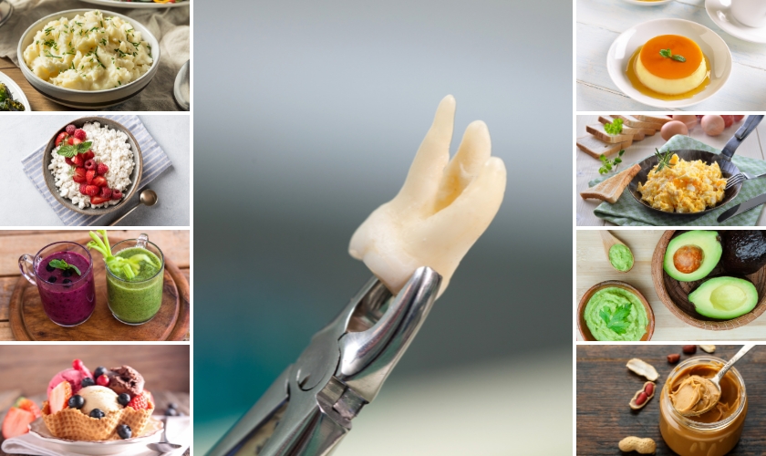 What Can You (and Can’t) Eat After Wisdom Teeth Removal?
