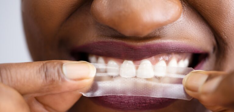 Do You Brush Your Teeth After Whitening Strips? Best Practices From Buford Dentist