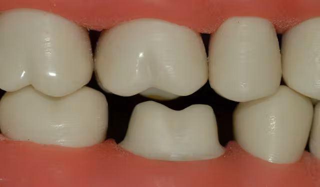 Factors That Influence Tooth Retention