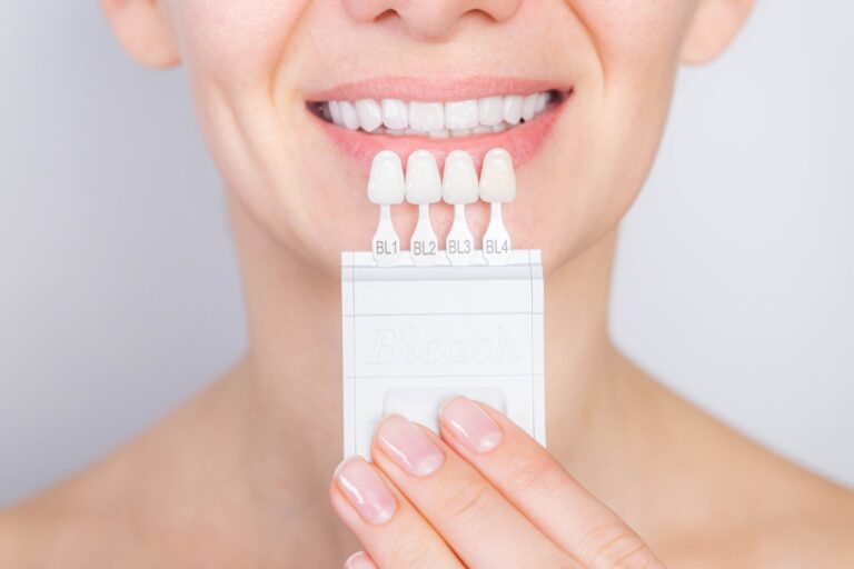 Are Veneers Worth It? Pros, Cons, and What to Expect