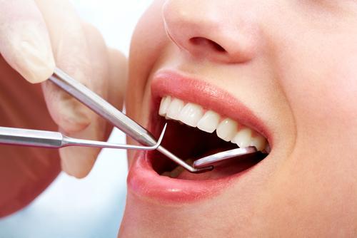 Comparing Dental Cleaning Recommendations