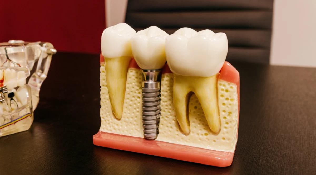 implant
