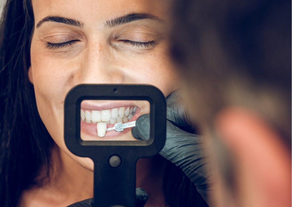 Patient comparing tooth shades during a cosmetic dentistry consultation for dental bonding vs veneers