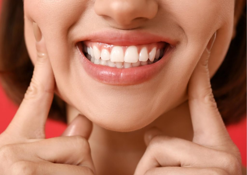 Close-up of a woman smiling and showing her teeth and gums after gummy smile treatment.