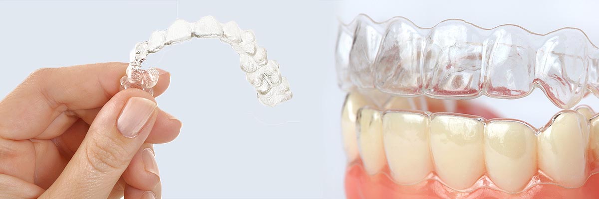 Buford Alternative to Braces for Teens