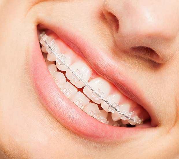 Buford Invisible Orthodontics