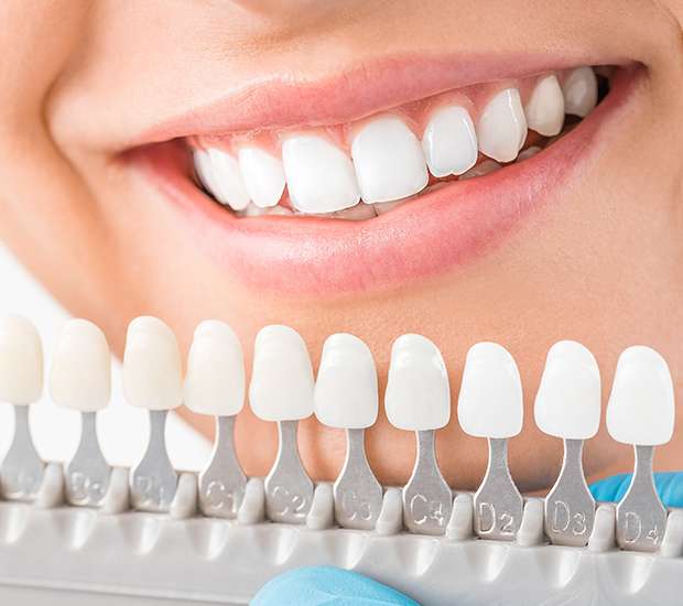 Buford Cosmetic Dentist