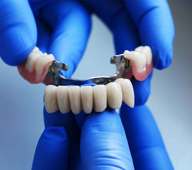Buford Dental Bridges