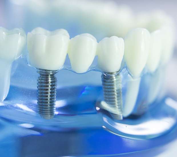 Buford Dental Prosthetics