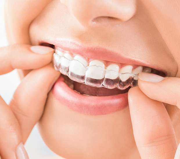 Buford Does Invisalign® Really Work?
