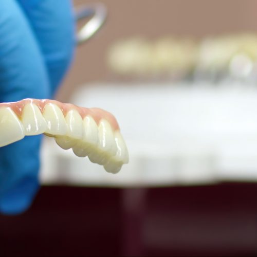 A dentist holds a porcelain fixed bridge - naccid buford dentist, GA