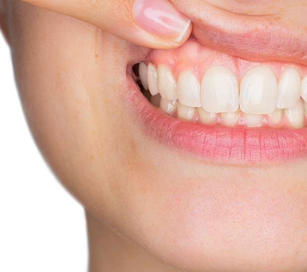 Buford Gum Disease