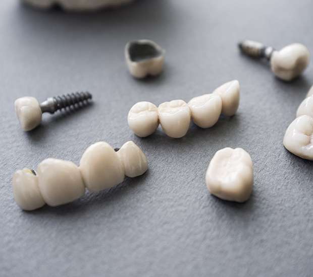 Buford The Difference Between Dental Implants and Mini Dental Implants