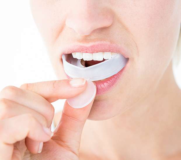 Buford Mouth Guards