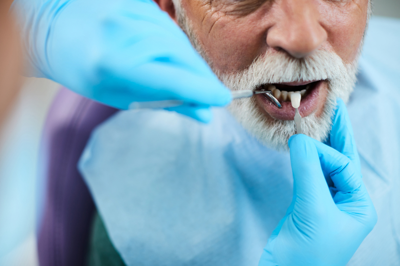 Dental Veneers: The Secret to a Confident Smile