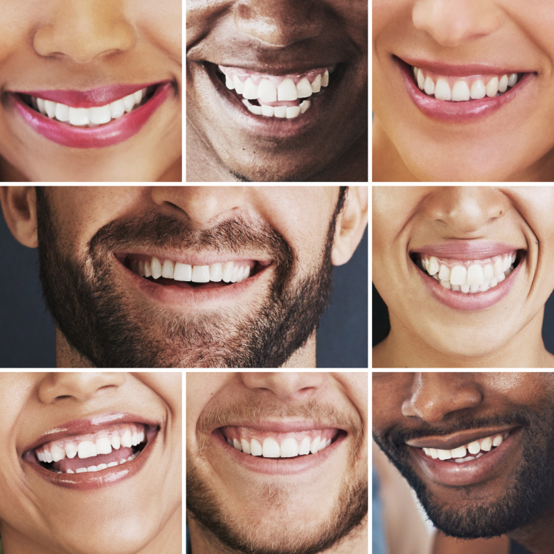 A collage of beautiful smiles thanks to cosmetic dentistry NACCID Buford Dentist (770)-932-1115