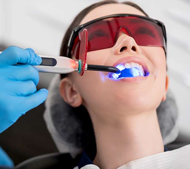 Buford Professional Teeth Whitening