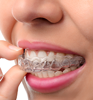 Clear Aligners - Almost Invisible Braces Buford, GA