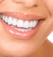Teeth Whitening Services Buford, GA