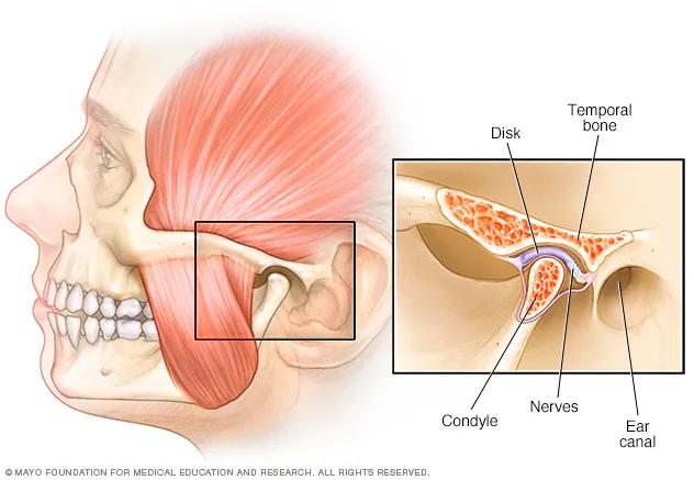 Can Weight Lifting Cause TMJ? Yes, and Here&rsquo;s Why | NACCID